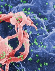 HIV