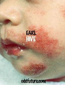 Hive