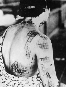 Hibakusha