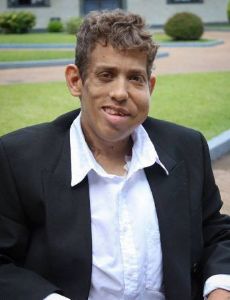 Christian Fritz (Síndrome de Proteus)