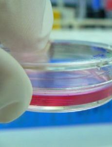 Cell culture