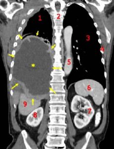Oncology