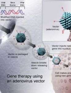 Gene therapy