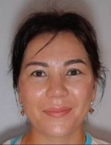 Ayman Kozhakhmetova