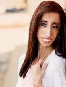 Lizzie Velasquez