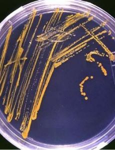 Microbiology