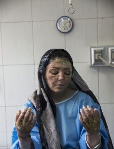 Acid attack