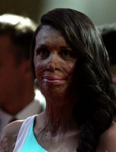 Turia Pitt