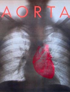 Aorta (band)