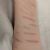 Self-harm