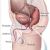 Prostate