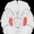 Hippocampus (brain)