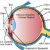 Intracameral injection