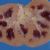 Kidney disease