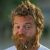 Ryan Dunn