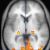 Functional magnetic resonance imaging