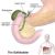 Gallbladder