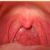 Laryngology