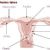 Endometrium