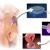 Assisted reproductive technology