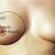 Anatomy of the breast
