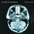 Breaking Benjamin albums