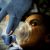 Anesthesia